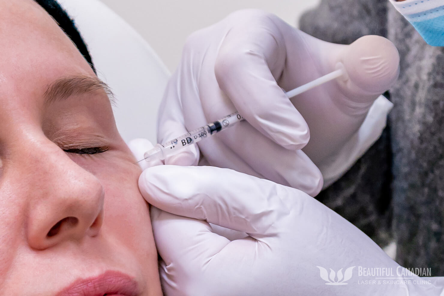 حقن البوتوكس